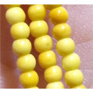 round yellow Rainforest Jasper beads, stability, approx 3mm dia, 15.5 inches